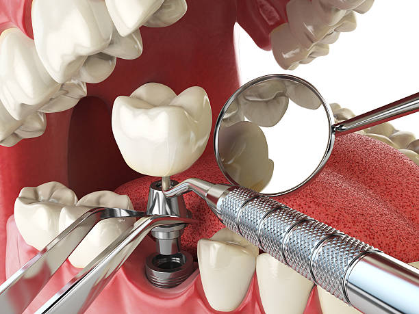 Fast & Reliable Emergency Dental Services in NM